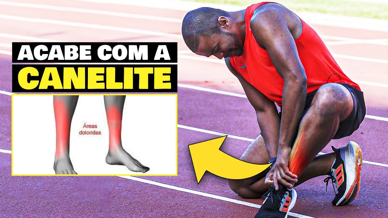 DOR NA CANELA: O QUE É, COMO EVITAR E COMO TRATAR