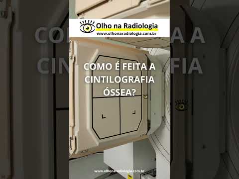 COMO É FEITA A CINTILOGRAFIA ÓSSEA - #shorts #radiologia #reels