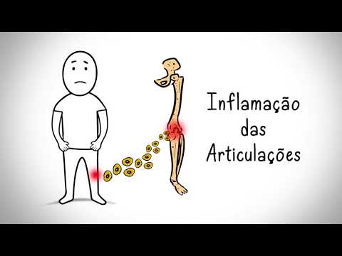Meniscus prolaps al tratamentului articulațiilor genunchiului