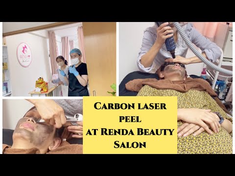 Carbon laser peel at Renda Beauty Salon|Reo king TV...