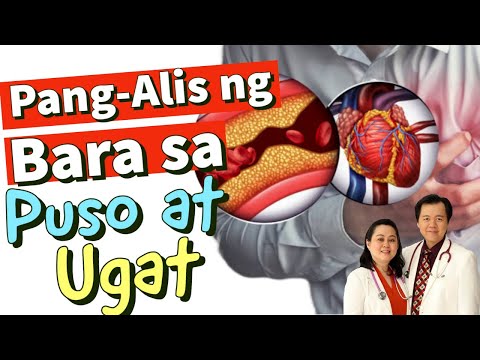 Pang-Alis ng Bara sa Puso at Ugat : Natural na Paraan - Payo ni Doc Willie Ong