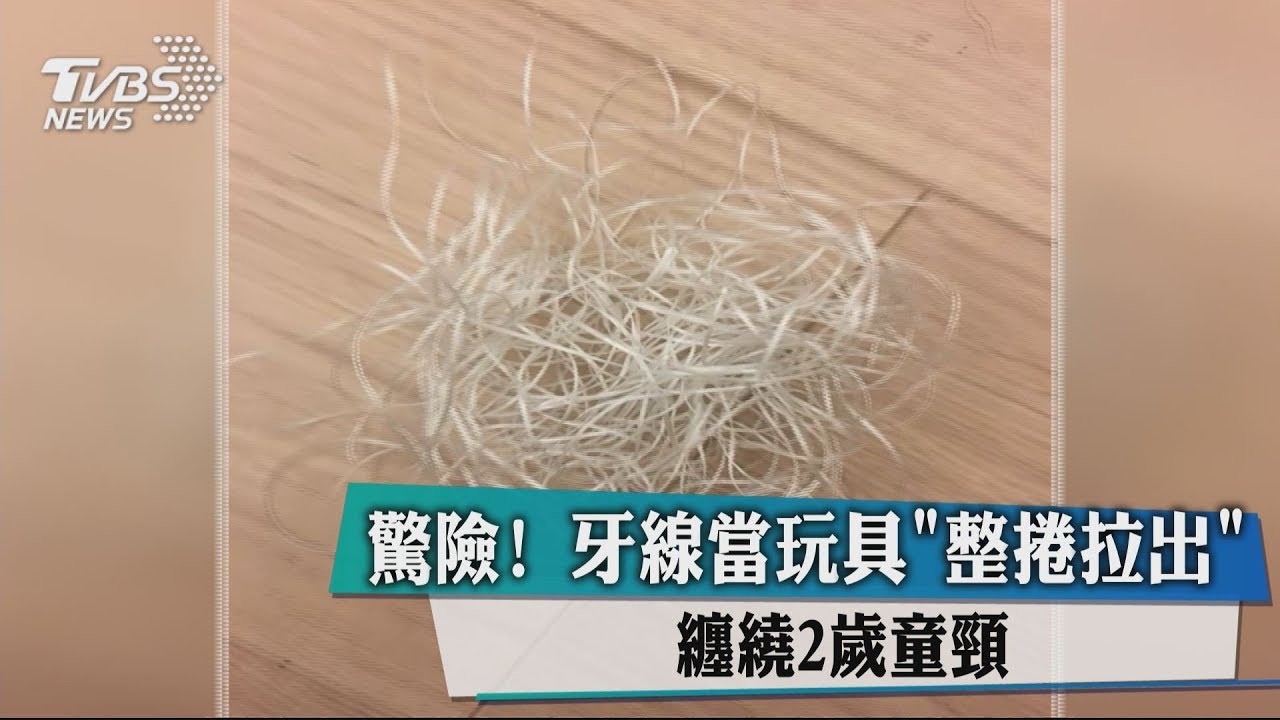 驚險!牙線當玩具「整捲拉出」 纏繞2歲童頸