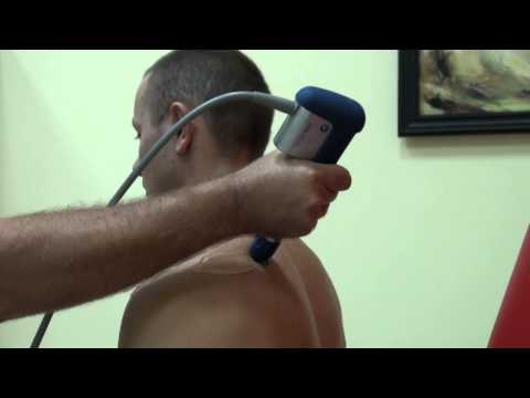 Terapia falą uderzeniową - Zapalenie lub zwapnienie ścięgna mięśnia nadgrzebieniowego