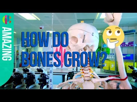 How do Bones Grow?? ☠️ | Operation Ouch!