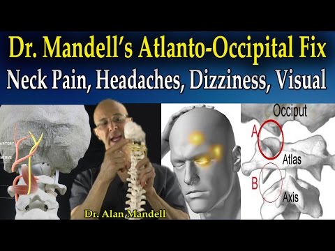 Dr Mandell's Atlanto-Occipital Fix for Headaches, Neck Pain, Trap, Interscapular, Dizziness, Visual