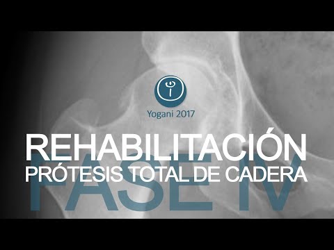 EJERCICIOS FASE IV - REHABILITACIÓN PRÓTESIS DE CADERA