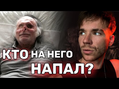 Потерял ЛИЦО после НАПАДЕНИЯ.😱 Жуткие истории.