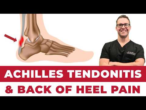 BEST 25 Plantar Fasciitis HOME Treatments Massage Stretches Shoes