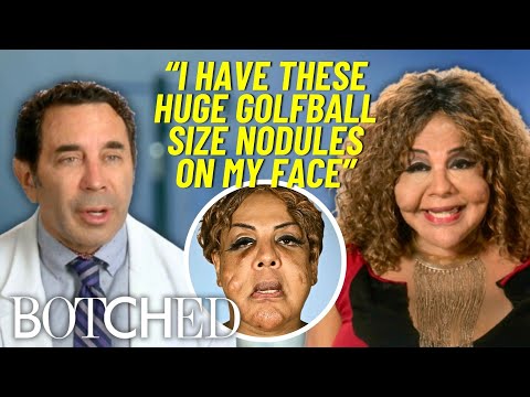 Rajee WAKES UP Mid-Surgery While Removing Black Market Cement Fillers | Botched | E!