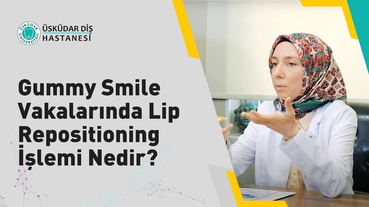 Gummy Smile Vakalarında Lip Repositioning İşlemi Nedir?