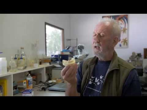 Capsaicin   a Quick Fix for Trigeminal Neuralgia