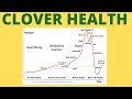 SMART MONEY VS DUMB MONEY | CLOVER HEALTH CLOV STOCK