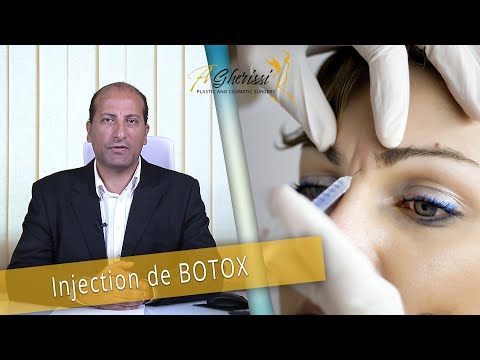 Vidéo explicative du Dr Anas Gherissi sur le traitement des rides par la toxine botulique