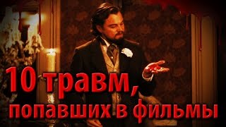 10 травм, попавших в фильмы