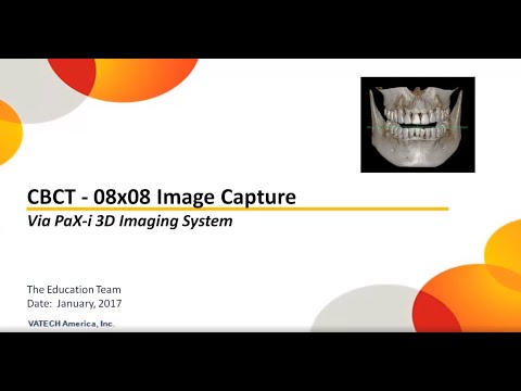 CBCT Image Capture - Detailed