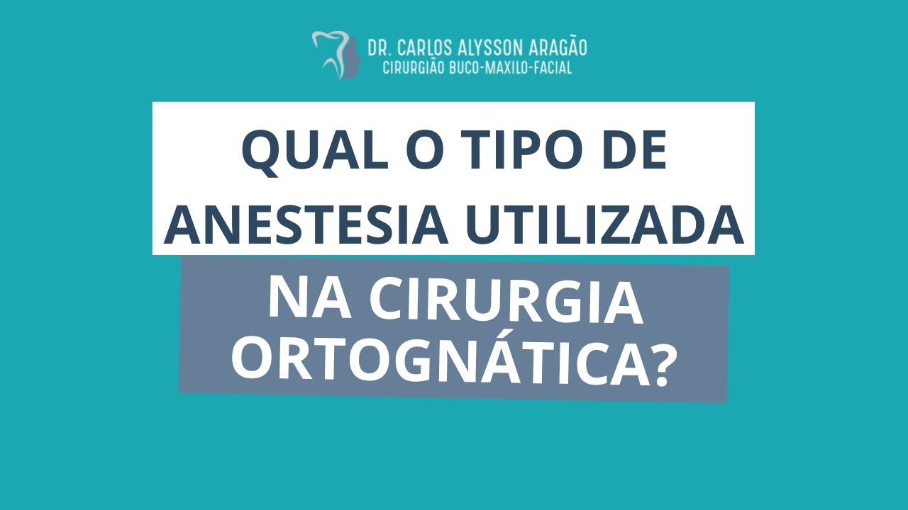 Carlos Alysson Aragão-41