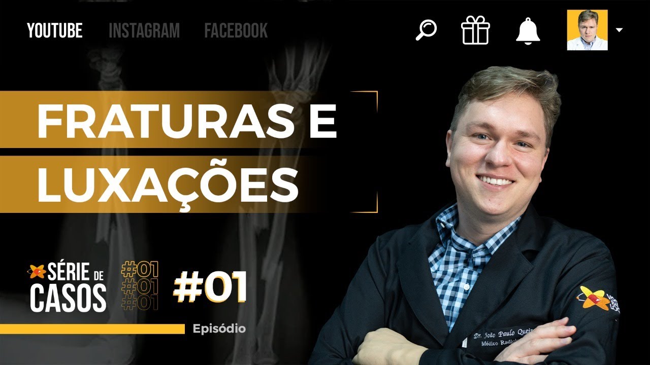 FRATURAS E LUXAÇÕES DOS MEMBROS SUPERIORES