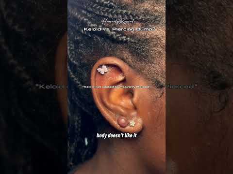 Difference btwn a keloid and a piercing ￼bump? #piercingjewelry #piercings #piercinglovers