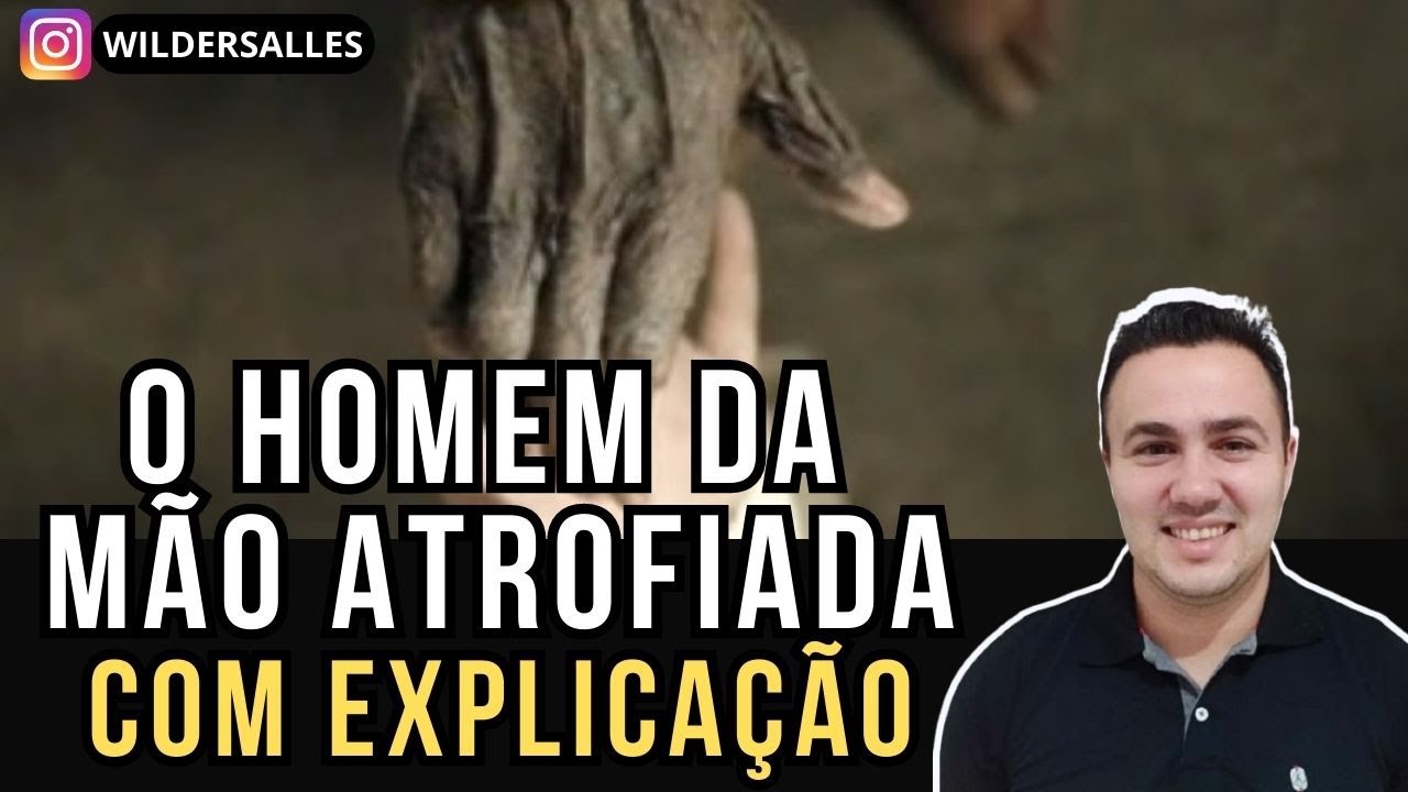 O HOMEM DA MÃO ATROFIADA (com explicação)