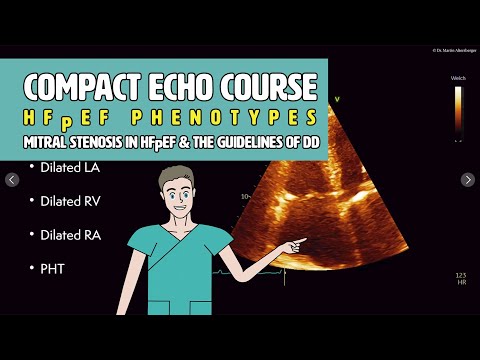 〖Echocardiography〗 HFpEF & mitral stenosis & DD Guidelines 💜