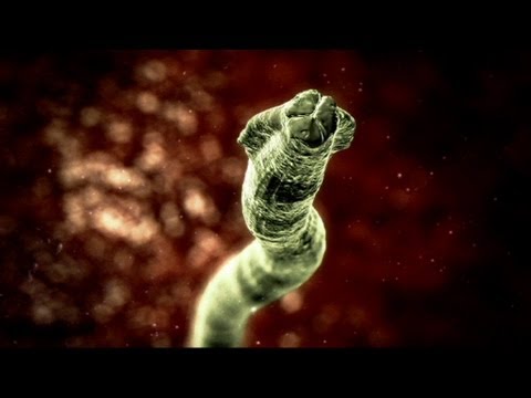 Deadly Roundworm - Monsters Inside Me Ep6