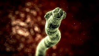 Deadly Roundworm - Monsters Inside Me Ep6