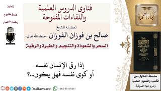 صورة ما حكم رقية أو كي الإنسان نفسه؟ لمعالي الشيخ صالح الفوزان