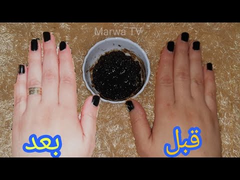 الوصفه القنبلة لتبييض اليدين والوجه والمناطق الحساسه صورة اليدين حقيقيه مش كذب