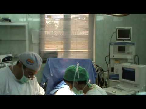 Varicoză și anestezie epidurală