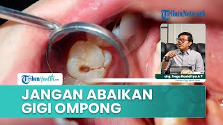 Penting! Bahaya Gigi Ompong Jika Dibiarkan Terlalu Lama bagi Kesehatan Mulut