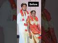Before Marriage After Marriage