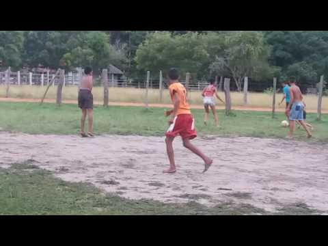 Adolescente sem os braços jogando futebol