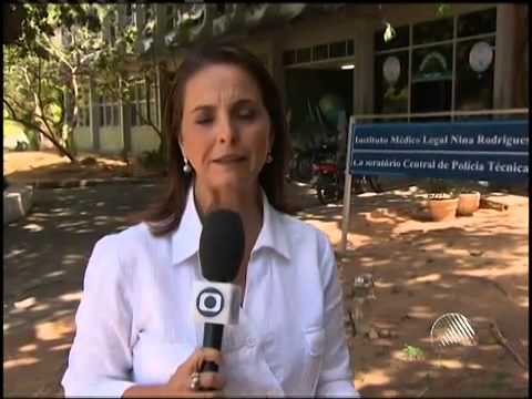 Mulher Morre No Hospital Com Queimaduras Após Briga Com O Marido