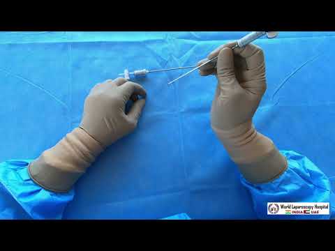 Use of Veress Needle and Hasson Cannula in Laparoscopic Surgery