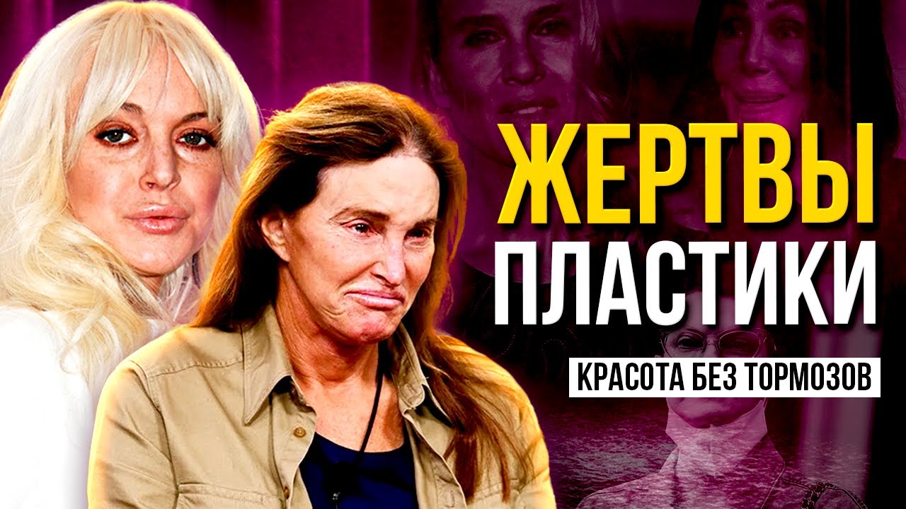 ЖЕРТВЫ ПЛАСТИКИ: В ПОГОНЕ ЗА КРАСОТОЙ ПОТЕРЯЛИ СЕБЯ