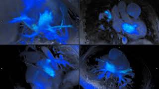 4D heart imaging