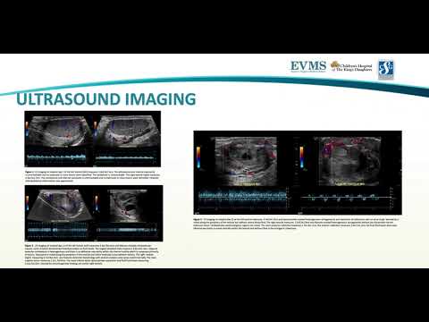 Thumbnail image of video presentation for A Case of Granulomatosis with Polyangiitis (Wegener's Granulomatosis) Presenting with Bilateral Testicular Ischemia and Necrosis