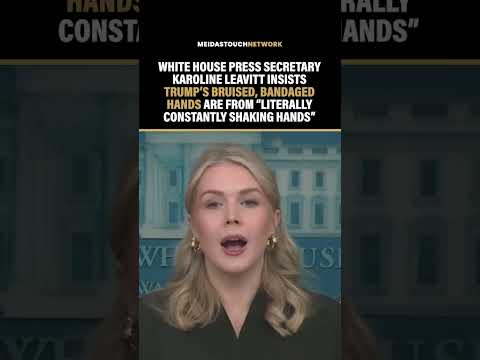 Trump Press Sec Makes LAUGHABLE EXCUSE for Trump HEALTH ISSUES