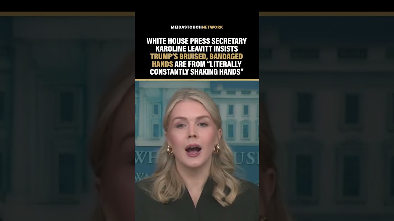 Trump Press Sec Makes LAUGHABLE EXCUSE for Trump HEALTH ISSUES