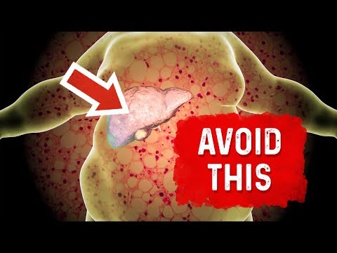 How Your Feet Are Warning You About Your Liver Problems Dr Berg Explains