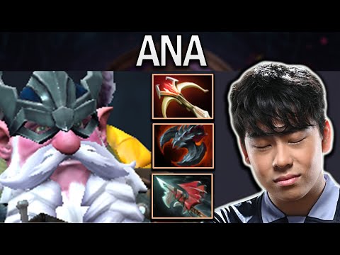 Sniper Dota 2 Gameplay Ana with 21 Kills and Daedalus