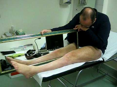 Giunti crioterapia a Mosca Indirizzo Ginnastica con osteoartrosi del ginocchio di video congiunta Evdokimenko