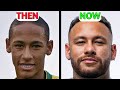 Neymar NEW FACE | Plastic Surgery Analysis