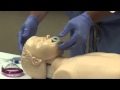 Airway Management
