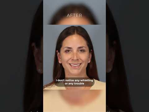 Leong Plastic Surgery NYC