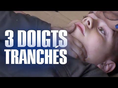 Un garçon de 16 ans AMPUTÉ des doigts : Pompiers, leur vie en direct - S2EP5 - Reportage - KM