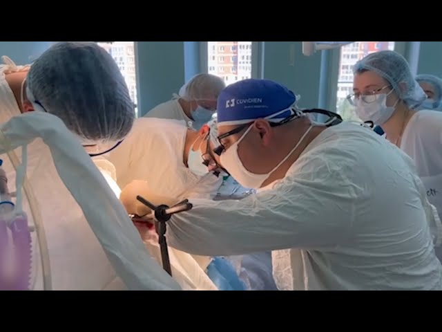 Хирурги Иркутска провели сложнейшую операцию – сплит-трансплантацию печени