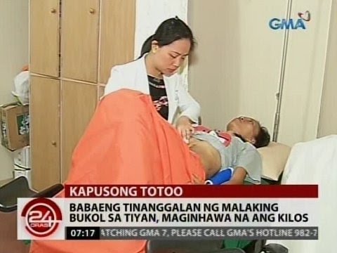 Kung paano upang mawala ang tugma pagkolekta ng timbang Safflower langis para sa pagbaba ng timbang mga review