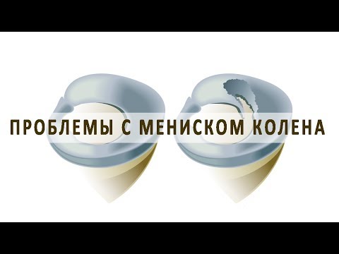 Боль в шее слева и сзади при повороте головы Боль в плечо и в шеи