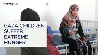 Video: 71,000 Gaza children at risk of malnutrition due to Israeli FOOD Blockade | TRT World